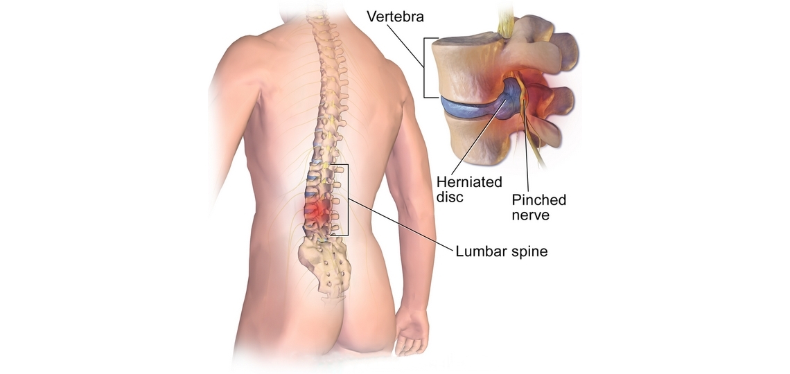 best physiotherapy in Dhaka