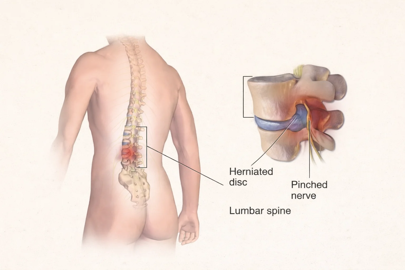 best physiotherapy center in Dhaka