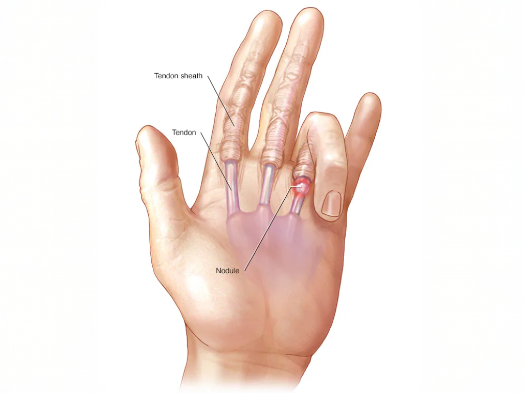 best physiotherapy center in Dhaka